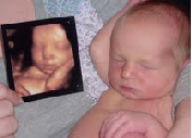 3d ultrasound before and after image ultrasound by (A Baby Visit)